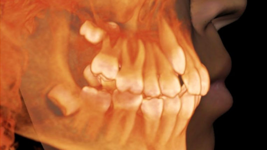 Schill Dental Clinic CT Schill Dental Clinic CT
