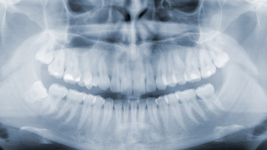 Technológia X-ray Schill Dental Clinc KaVo Technológia X-ray Schill Dental Clinc KaVo