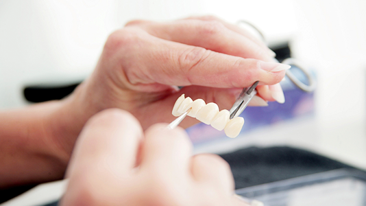 Schill Dental Clinic Zubné mostíky Schill Dental Clinic Zubné mostíky