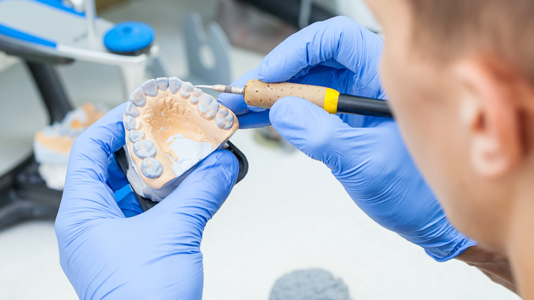 Zubné náhrady v Schill Dental Clinic Zubné náhrady